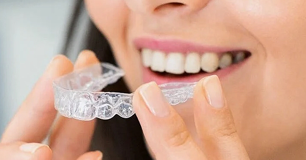 5 Facts About Invisalign Treatment