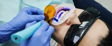7 Perks of Teeth Whitening | Cosmetic Dentistry | San Francisco 7 Perks of Teeth Whitening | Cosmetic Dentistry | San Francisco