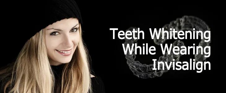 Can You Whiten Teeth Wearing An Invisalign Can You Whiten Teeth Wearing An Invisalign
