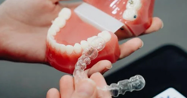 What is the Difference Between Invisalign and Invisalign Teen? What is the Difference Between Invisalign and Invisalign Teen?