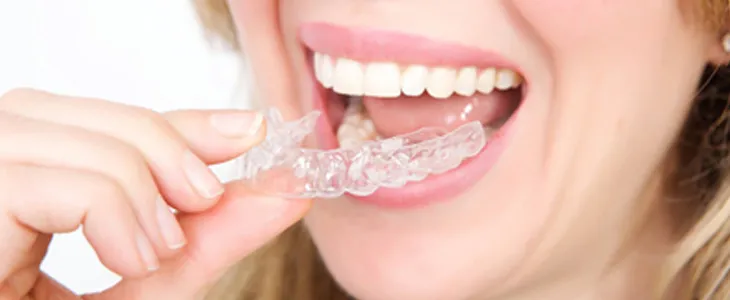 What Is TMJ and Will Invisalign Fix TMJ? What Is TMJ and Will Invisalign Fix TMJ?