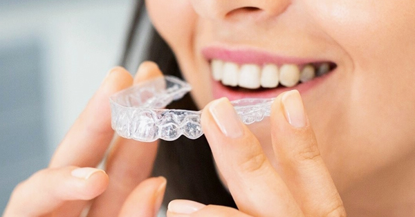 How Often to See a Dentist for Invisalign? How Often to See a Dentist for Invisalign?