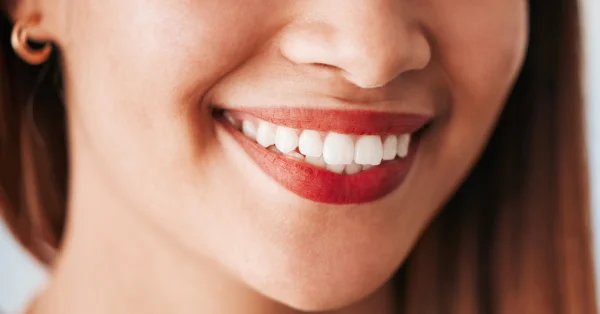Myths You Should Know About Teeth Whitening in San Francisco Myths You Should Know About Teeth Whitening in San Francisco