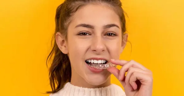 Possibility of Root Canal After Wearing Invisalign Possibility of Root Canal After Wearing Invisalign