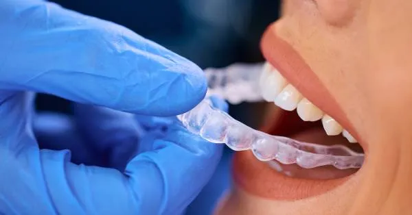 The 6 Health Benefits of Invisalign in San Francisco The 6 Health Benefits of Invisalign in San Francisco