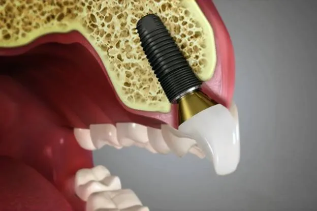 4 Cosmetic Dentistry Treatments to Try This New Year 4 Cosmetic Dentistry Treatments to Try This New Year