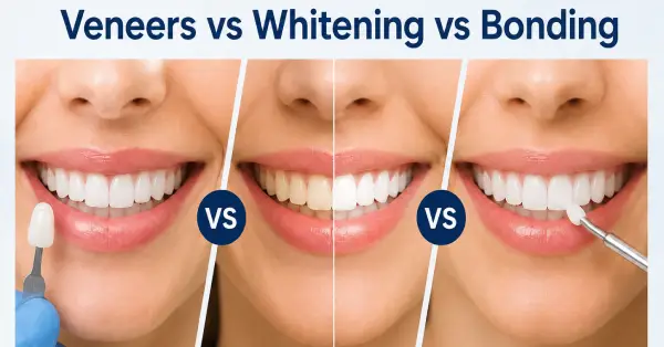 Helpful dental information about cosmetic dentistry in San Francisco