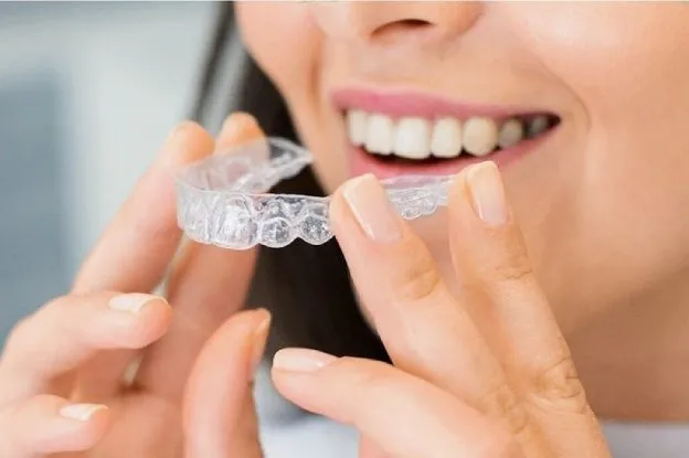 What I Should Know About Invisalign What I Should Know About Invisalign