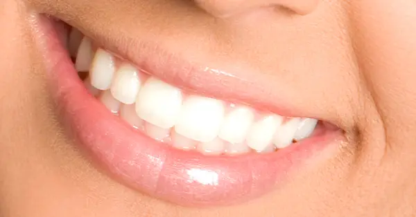 Helpful dental information about teeth whitening San Francisco
