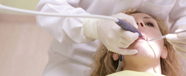 Tooth Extractions San Francisco Tooth Extractions San Francisco